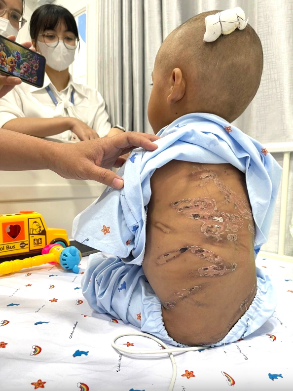 Thông tin mới nhất vụ bé trai 2 tuổi bị bạo hành dã man ở TP.HCM